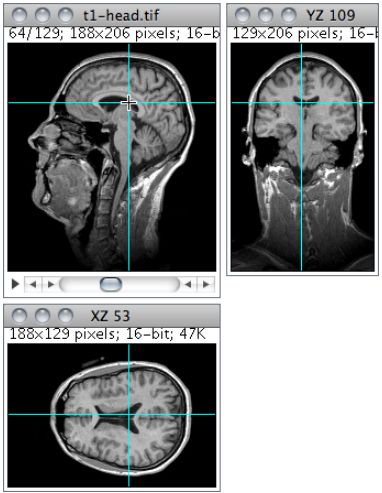 imagej灰度分析结果（imagej灰度分析使用步骤）