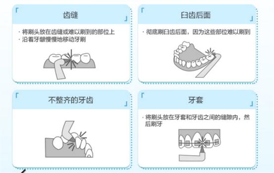 款性价比高的冲牙器品牌推荐（它们绝对是清洁牙齿的好帮手）"